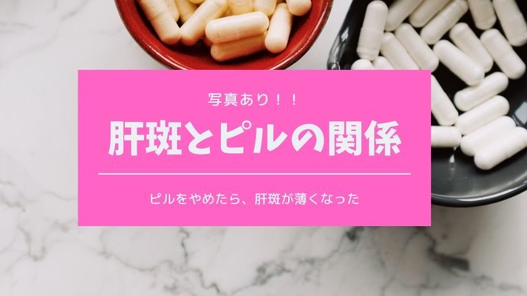 肝斑とピルの関係 ピルをやめたら肝斑が薄くなった 写真有り